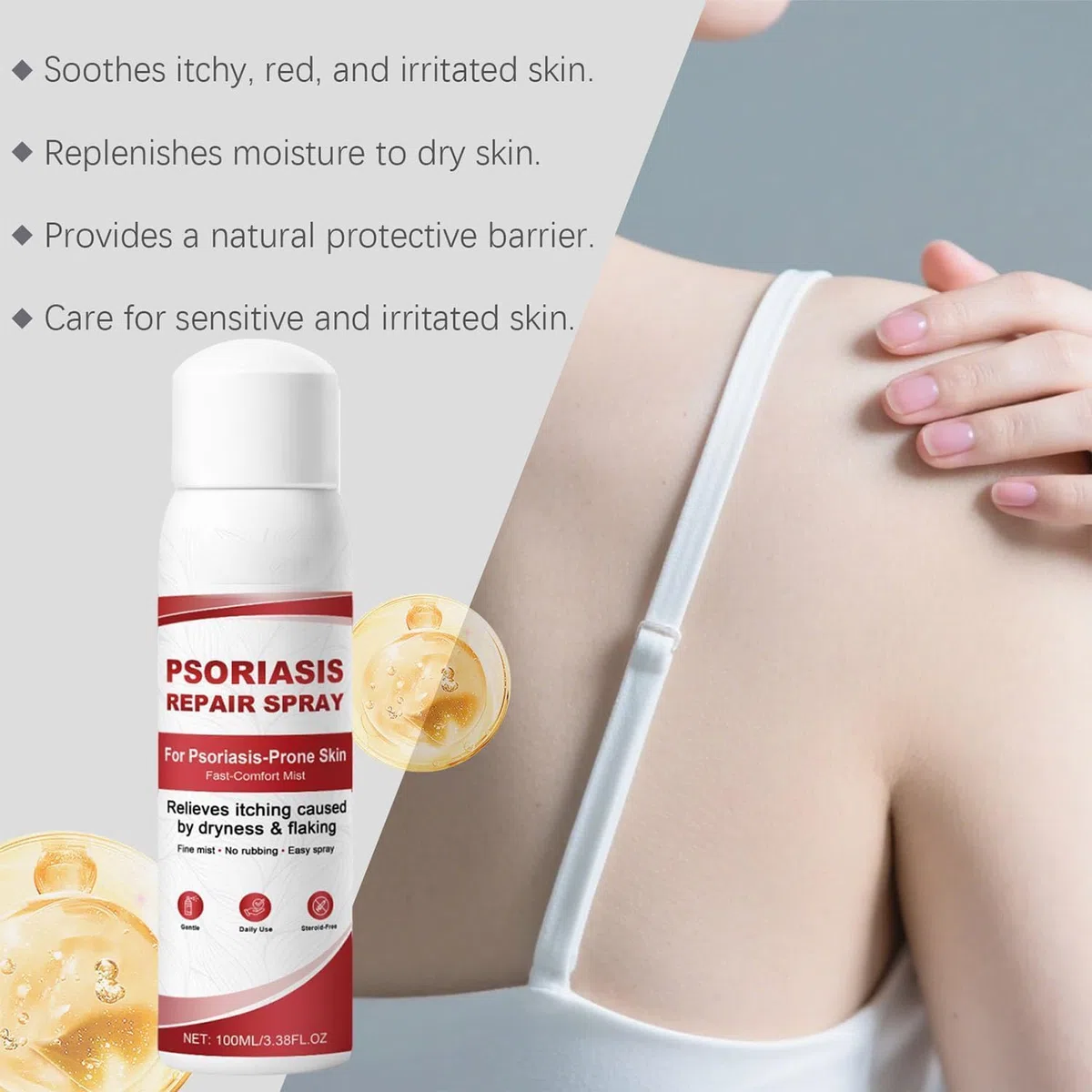Sprays para el alivio de la psoriasis, Spray para el cuidado de la piel, Spray herbal de magnesio para la psoriasis, para todo tipo de piel